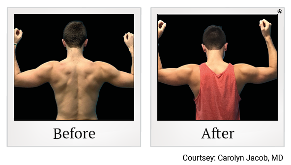 results for muscle sculpting in Wadsworth