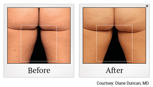 results for muscle building in Wadsworth