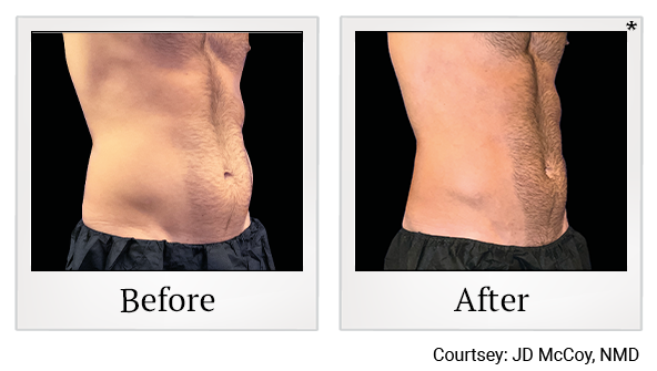 results for body sculpting in Wadsworth