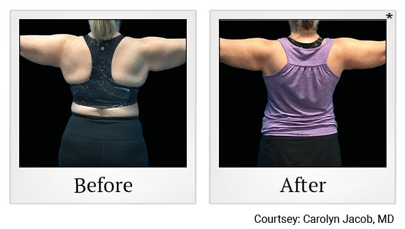 results for fat burning in Wadsworth